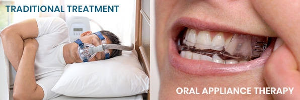 oral applience therapy